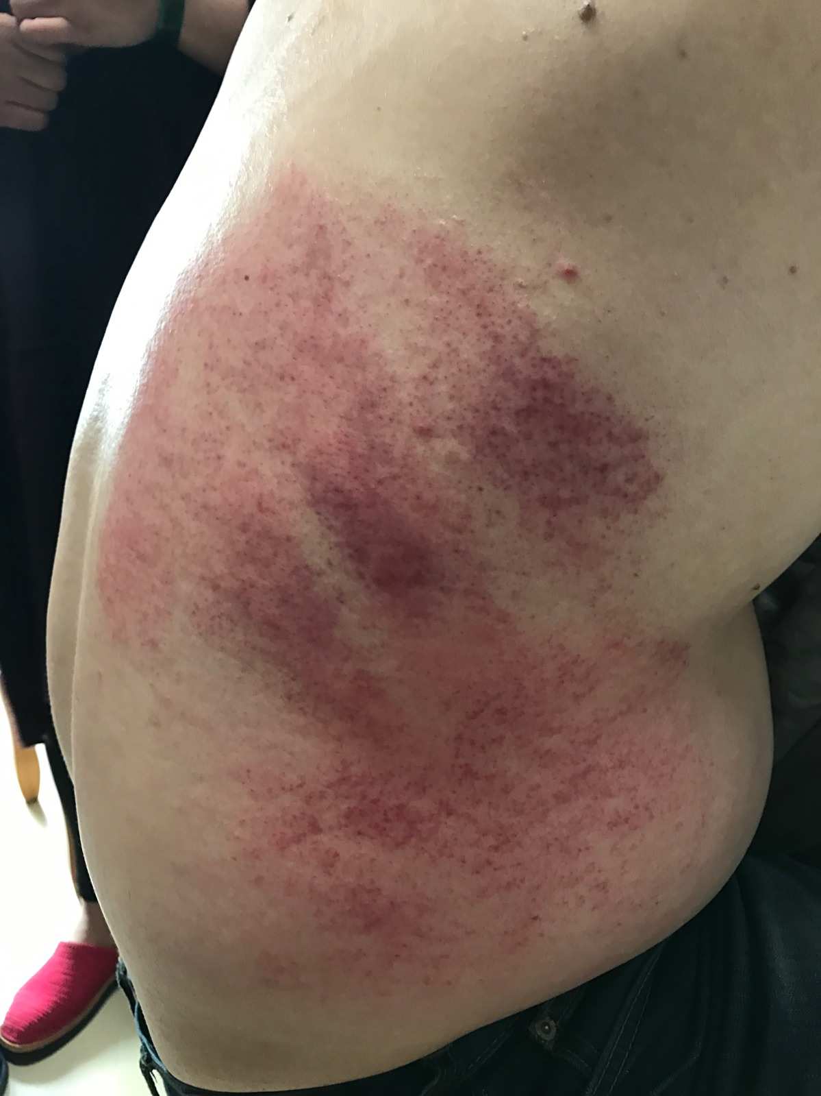 针对部位掌握力度
