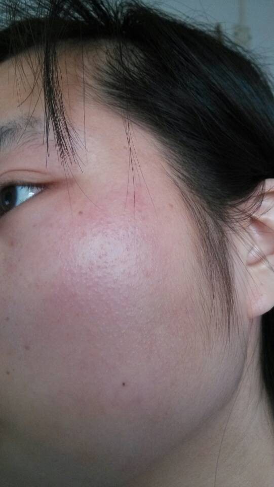 瘙痒是怎么引起的？