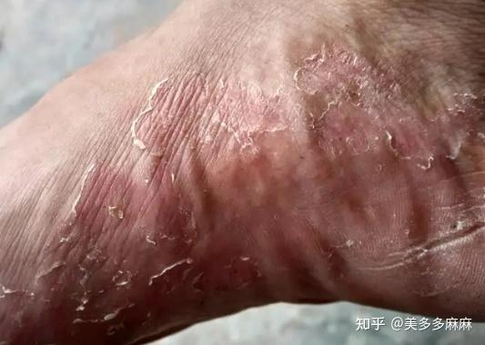 1. 清洁保持