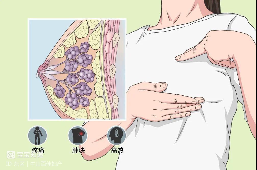 通乳师的培训和技能