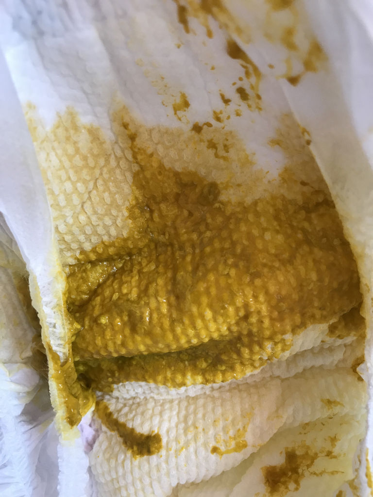 宝宝拉肚子的原因