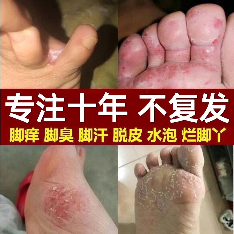 2. 药物B