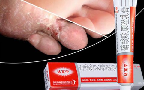 治疗脚气用哪些药最好最有效(选择正确的药物来治疗脚气)